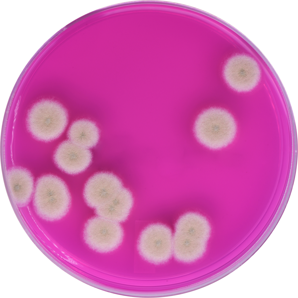 detecting-microbial-contamination-in-cannabis